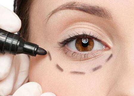 蘇州哪位醫(yī)生修復(fù)雙眼皮失敗靠譜？案例分享有人氣！