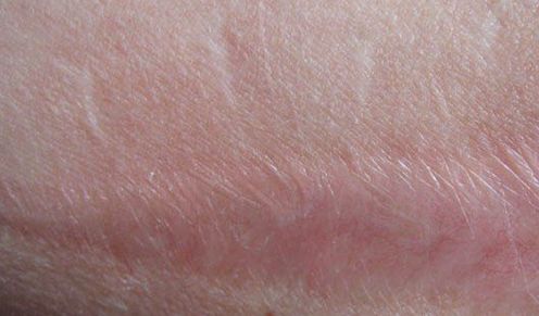 嘉興有哪些專業(yè)的醫(yī)美機(jī)構(gòu)提供雙眼皮手術(shù)？