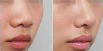 溫州和平整形醫(yī)院有哪些主要項(xiàng)目呢？