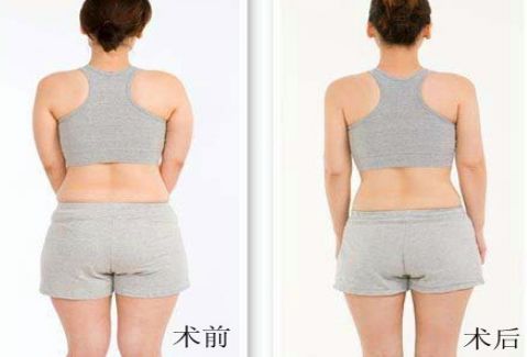 洛陽雙眼皮好的醫(yī)院有哪些？