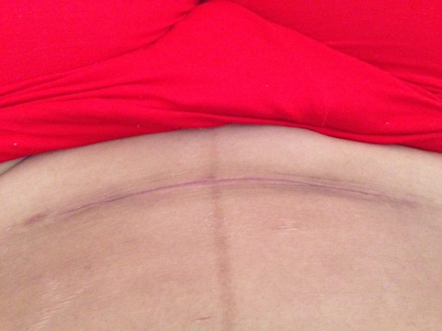 郭祥文雙眼皮風格揭秘，醫(yī)生經(jīng)歷與精美案例分享