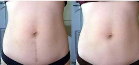 成都眼袋整形醫(yī)院哪家好？選擇專業(yè)整形醫(yī)院護(hù)你年輕無眼袋