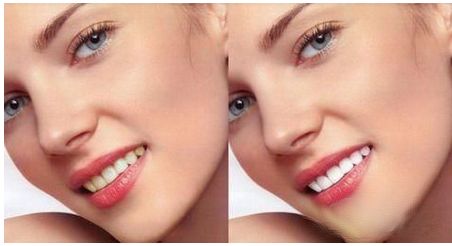 樸正國正頜手術有哪些風格審美？