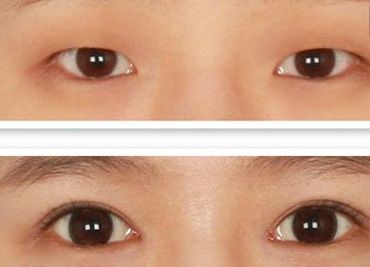 鄭州哪家美容醫(yī)院正規(guī)且口碑好？