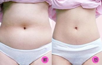 【2023吉林雙眼皮手術(shù)評(píng)測(cè)】哪家醫(yī)院值得信賴？