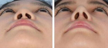 衢州做小手術(shù)哪家醫(yī)院好？快速推薦衢州當?shù)貙I(yè)的醫(yī)院