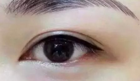 福州秀清醫(yī)療美容整形醫(yī)院的資質(zhì)和口碑怎么樣？