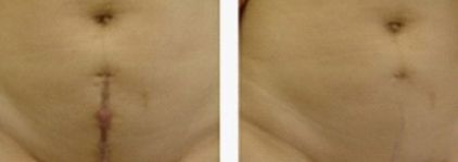 深圳私密整形醫(yī)院哪家好？讓我們來為您推薦最佳選擇