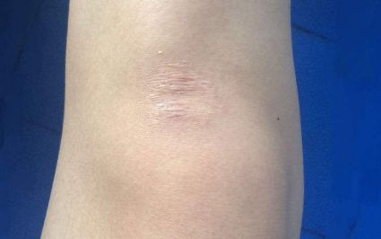 ?？诔暼パ鄞罴堰x擇有哪些？評價最好的醫(yī)療機構(gòu)大揭秘！