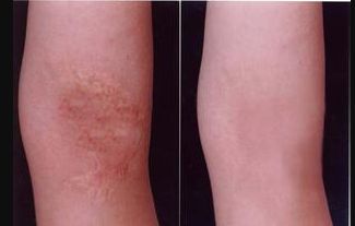 廈門哪家醫(yī)院整鼻子效果好，選擇哪家醫(yī)院才能安心？