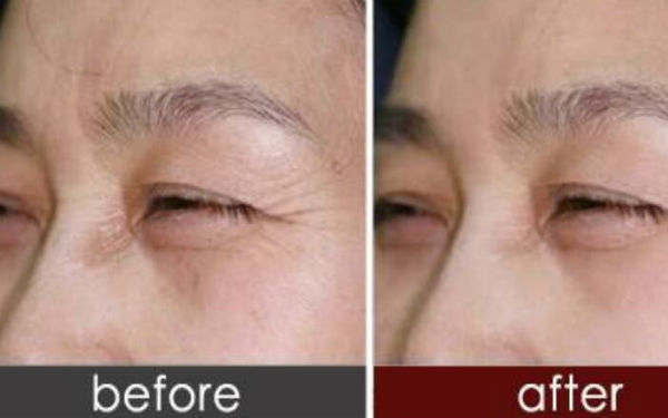 上海肋骨鼻哪位專家技術(shù)過硬？人氣牛仔鼻醫(yī)生排名大曝光！