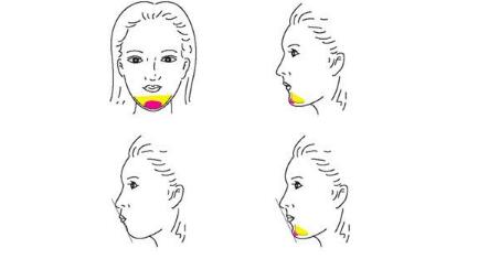 王大太的鼻子整形效果怎么樣？醫(yī)生是哪里的？技術(shù)水平如何？坐診醫(yī)院及當(dāng)?shù)貓髢r揭秘