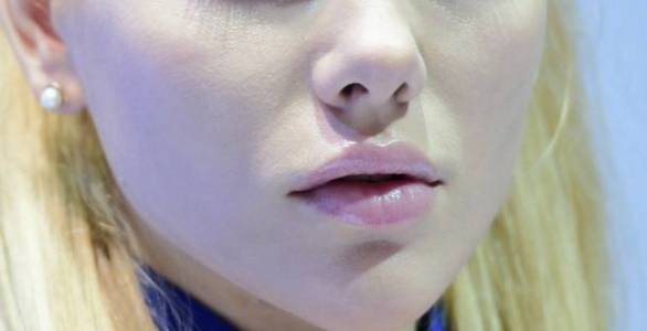 2023成都胸部下垂嚴(yán)重整形專家排行榜前十(鞏永強(qiáng)、田秋梅、李川名單口碑怎么樣)