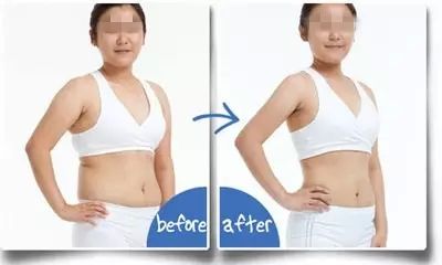 2023成都抽脂隆胸整形上榜清單前十名專家(秦曉、鄧兵、賈映缽價(jià)格不貴口碑好)