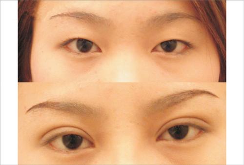 2023合肥水動力吸脂瘦肚子10強醫(yī)生(朱德剛、孫洋、徐泓實力口碑滿分！)