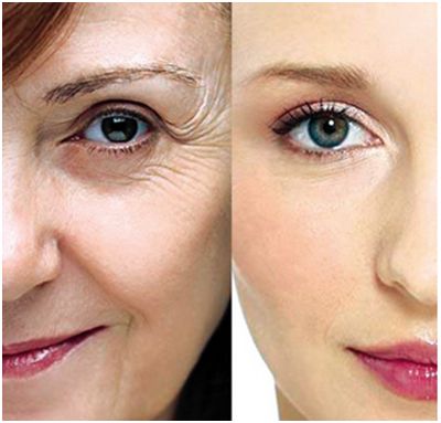 上海哪家醫(yī)院做去眼袋手術(shù)效果好？