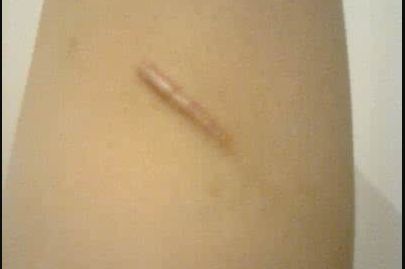 濟(jì)寧哪家做假體隆胸好？揭秘濟(jì)寧最受歡迎的假體隆胸醫(yī)院！