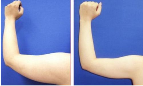 重慶整形美容醫(yī)院哪家好？最權(quán)威的整形美容醫(yī)院盤點(diǎn)