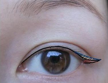 徐州哪家醫(yī)院祛痣效果好又實(shí)惠？