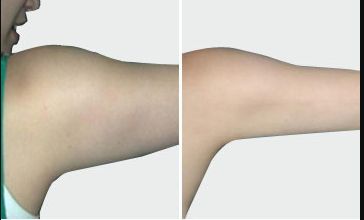 上海中國(guó)去疤痕醫(yī)院哪家好？高效去除疤痕的專(zhuān)業(yè)醫(yī)院推薦