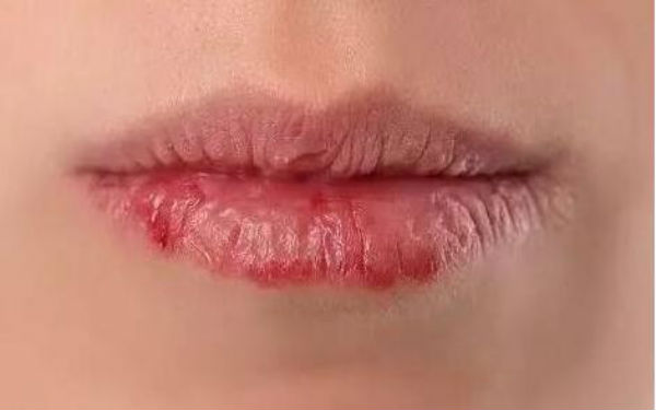 2023石家莊做眼袋手術(shù)評(píng)分十強(qiáng)醫(yī)生(王晶晶、種冬至、宋倩都是行業(yè)內(nèi)的佼佼者！)