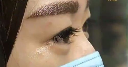 武漢招風(fēng)耳矯正哪家好？尋找專(zhuān)業(yè)耳部矯正專(zhuān)家的最佳選擇