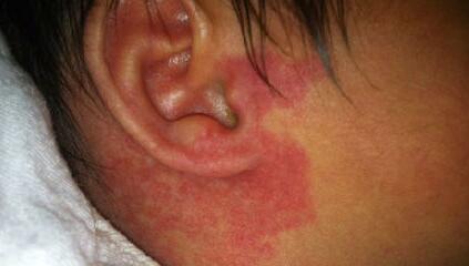 成都莊醫(yī)生醫(yī)美院口碑如何