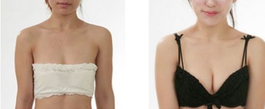 大連市做雙眼皮哪家好？了解大連市雙眼皮手術的費用、效果和口碑