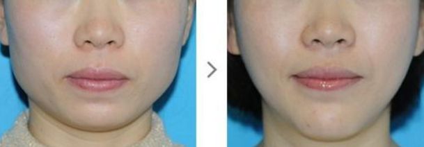 深圳哪家去色斑醫(yī)院好？專家推薦這些知名醫(yī)療機構(gòu)