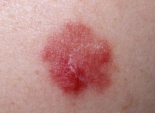 北京鼻修復(fù)醫(yī)生評(píng)價(jià)：劉彥軍、薛軼群技術(shù)對(duì)比，附價(jià)格一覽