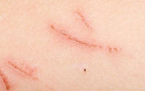 南陽市拉皮除皺手術(shù)哪家好？選擇何種醫(yī)院更安心？