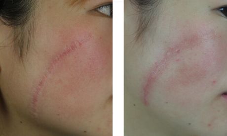 鄭州眼部整形哪家醫(yī)院好？醫(yī)生經(jīng)驗與患者口碑共推薦！