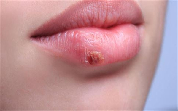 2023天津乳頭射頻懸吊正規(guī)專家口碑TOP10(李會民、金松、孫澤芳口碑好評不斷)