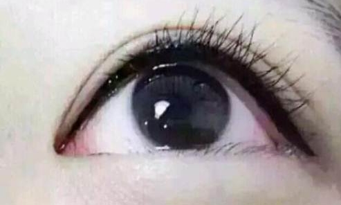 廣州曙光醫(yī)學美容醫(yī)院的黎凍抗衰老療法有多出色？