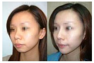 秦皇島美容美體哪家好？刷爆朋友圈的秘密美容院大揭秘！