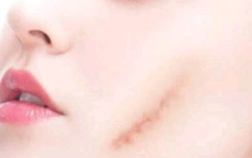 濰坊哪家醫(yī)院做抽脂整形好，服務(wù)好口碑好？