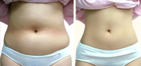 上海哪家醫(yī)院做美容手術(shù)好？——選擇上海做美容手術(shù)醫(yī)院的首選方案