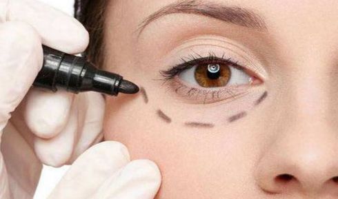 深圳分體式隱形隆鼻醫(yī)院十強榜單揭曉！