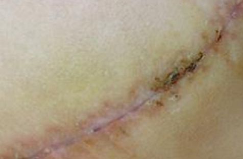 重慶去斑好的醫(yī)院哪家好？權(quán)威推薦，告訴您重慶著名的去斑治療醫(yī)院!