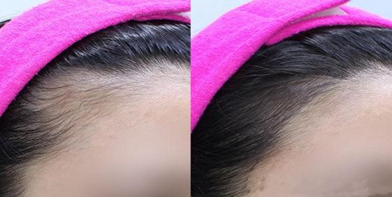 安陽(yáng)民營(yíng)整形醫(yī)院排名前三，哪家效果好的口碑最佳？