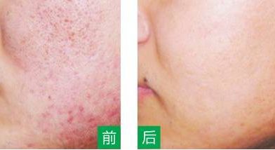 永州美辰醫(yī)療整形醫(yī)院的價(jià)格如何？收費(fèi)標(biāo)準(zhǔn)透明公開，術(shù)前注意事項(xiàng)必看！