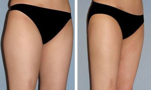 北京好的豐面部醫(yī)院哪家好？口碑最佳推薦！