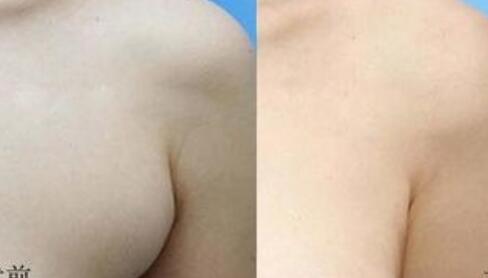 四惠中醫(yī)院植發(fā)技術(shù)之谷遠(yuǎn)飛、王繼萍醫(yī)生介紹及價(jià)格表