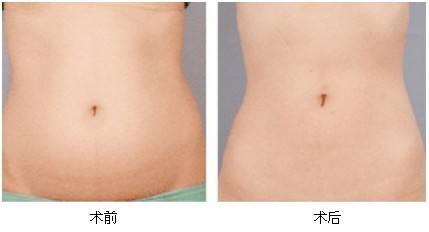 2023東莞激光磨皮除皺推薦十強(qiáng)專家(王麗沙、朱曉梅、黃雙聞入圍的都是當(dāng)?shù)蒯t(yī)美領(lǐng)頭羊)