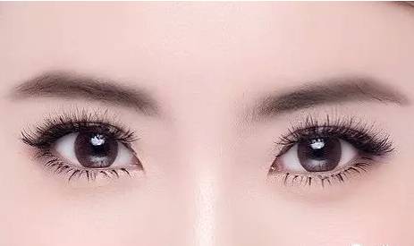 宋保強(qiáng)雙眼皮修復(fù)醫(yī)生評(píng)價(jià)及成功案例分享