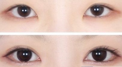 海口做隆鼻醫(yī)院哪家好？?？谀募艺葆t(yī)院的鼻部整形效果好且口碑贊？