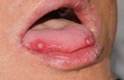 2023清遠顴骨縮小失敗修復醫(yī)生強榜前十名(孫森、丘金俊、丘金俊效果自然美觀)