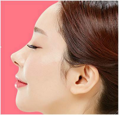 2023杭州抽脂冷凍溶脂排名榜TOP10的醫(yī)生(馮應(yīng)宏、陳鳴琦、高壽松值得信賴的選擇！)