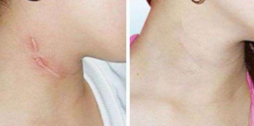 南京整形醫(yī)院哪家好又實惠？全面評估南京整容手術價格與口碑