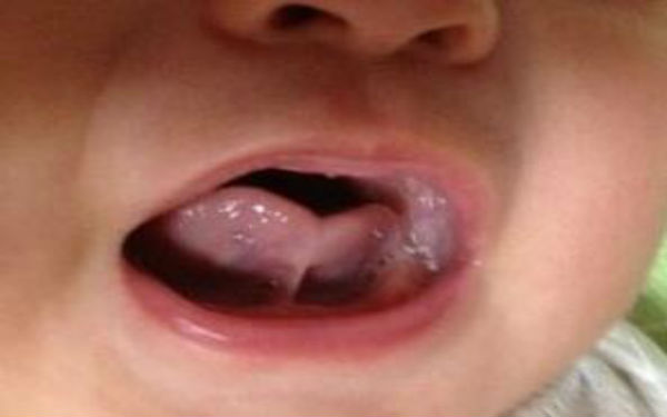 2023九江針雕去除頸紋專家口碑榜前十強(qiáng)(宗艷霞、郭善勇、郭仁洙收費(fèi)都不貴的)